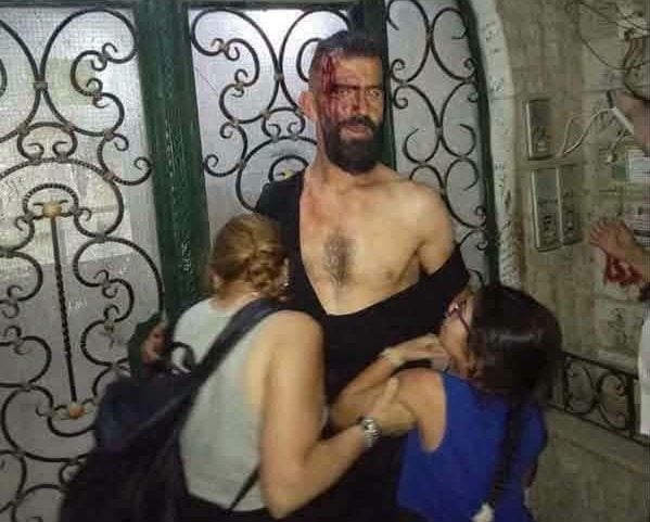 شبان يعتدون بالضرب على الناشط رائد الصادق في جرمانا بعد اتهامه بالإساءة لأهالي المنطقة